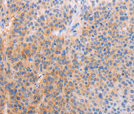 ADHFE1 Polyclonal Antibody (E-AB-16141)