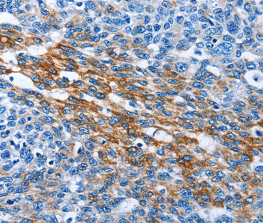 PAK6 Polyclonal Antibody (E-AB-14280)