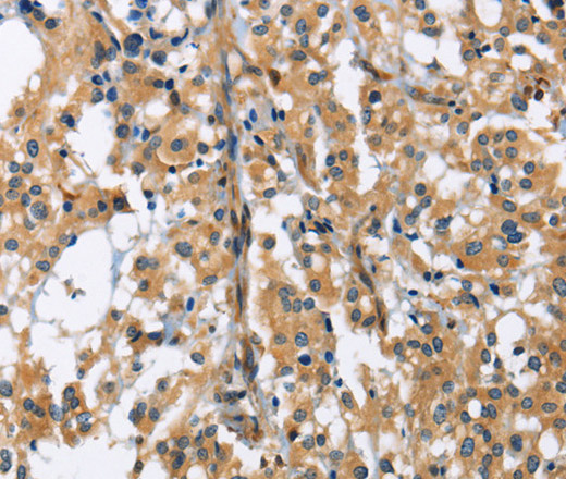 GAB1 Polyclonal Antibody (E-AB-10843)
