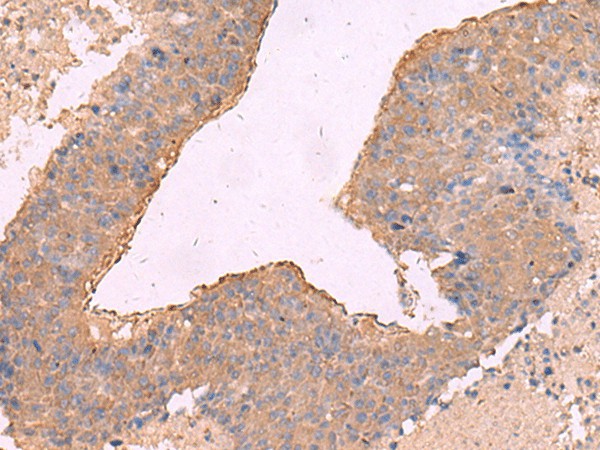 NIPSNAP1 Polyclonal Antibody (E-AB-18175)