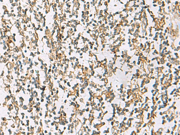ZPBP2 Polyclonal Antibody (E-AB-18475)