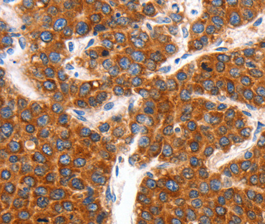 KCNC2 Polyclonal Antibody (E-AB-15741)