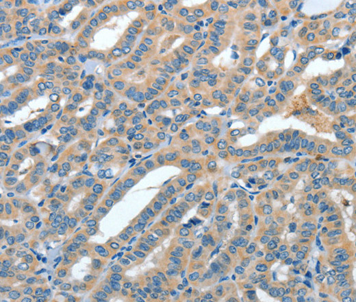 ANGPT1 Polyclonal Antibody (E-AB-10133)