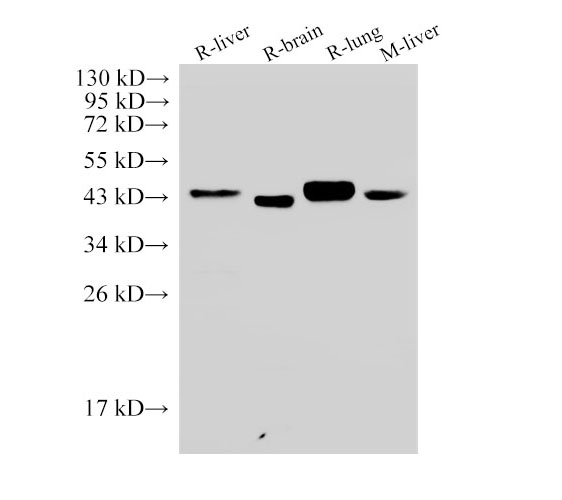 CD38 Polyclonal Antibody (E-AB-40435)