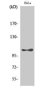 Phospho-EEF2K (Ser366) Polyclonal Antibody (E-AB-21142)