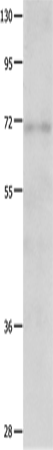 IGF2BP1 Polyclonal Antibody (E-AB-12432)