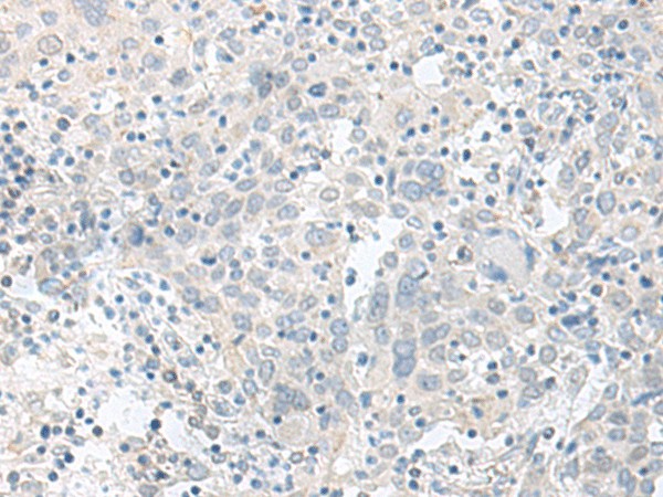 TIMM8A Polyclonal Antibody (E-AB-52670)