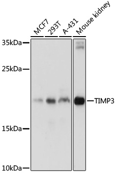 TIMP3 Polyclonal Antibody (E-AB-65858)