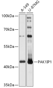 PAK1IP1 Polyclonal Antibody (E-AB-91881)