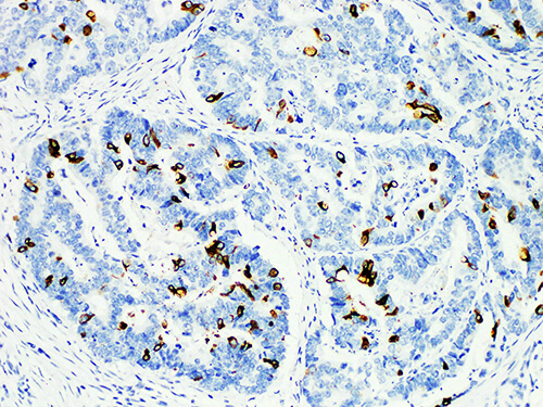 MUC2 Monoclonal Antibody (ELAB6197-M)