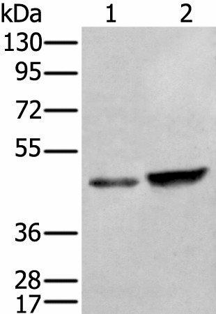 ZNF24 Polyclonal Antibody (E-AB-18455)