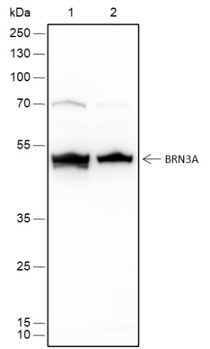Recombinant BRN3A Monoclonal Antibody (AN301749L)