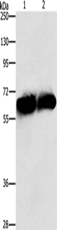 ASNS Polyclonal Antibody (E-AB-14755)