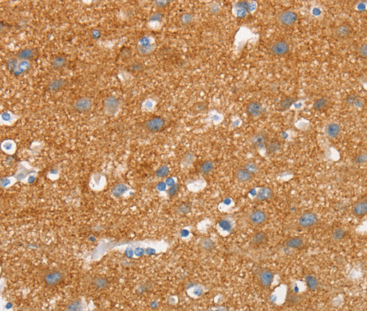 SNCA Polyclonal Antibody (E-AB-13070)
