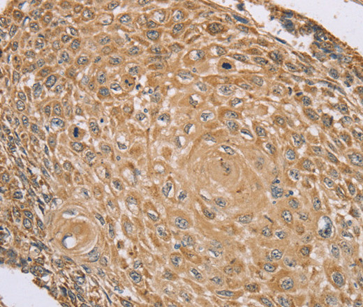 RNF148 Polyclonal Antibody (E-AB-13572)