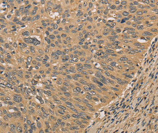 PRDM14 Polyclonal Antibody (E-AB-10852)
