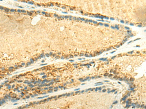 EEF1AKMT2 Polyclonal Antibody (E-AB-52841)
