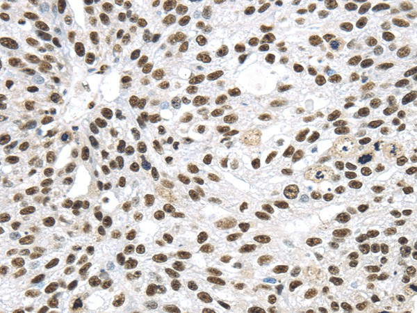 DDX39B Polyclonal Antibody (E-AB-17498)