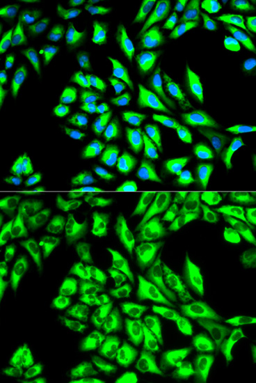 EEF1A1 Polyclonal Antibody (E-AB-60119)
