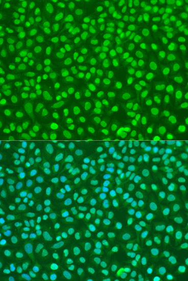 NBN Polyclonal Antibody (E-AB-62135)