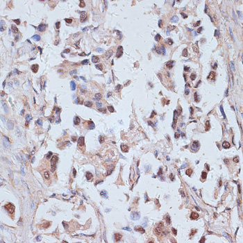 TAX1BP1 Polyclonal Antibody (E-AB-67028)