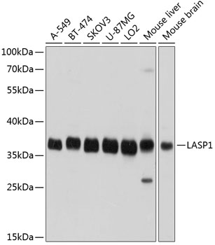 LASP1 Polyclonal Antibody (E-AB-63766)