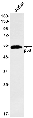 Recombinant p53 Monoclonal Antibody (E-AB-81592)
