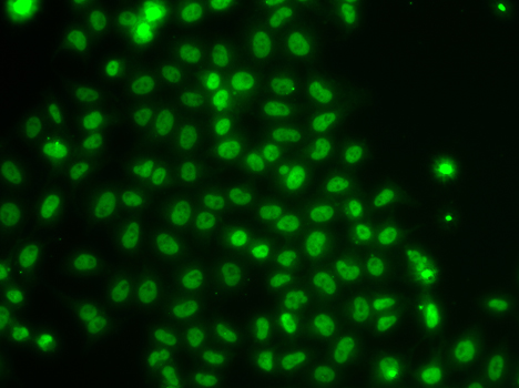 TOX Polyclonal Antibody (E-AB-62322)
