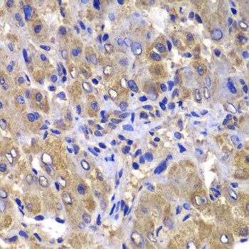 CARD10 Polyclonal Antibody (E-AB-61673)