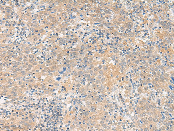 GALP Polyclonal Antibody (E-AB-19891)