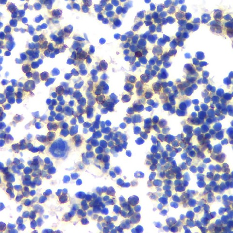 MMP13 Polyclonal Antibody (E-AB-70107)