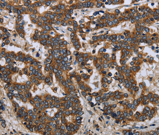 LGALS2 Polyclonal Antibody (E-AB-14095)