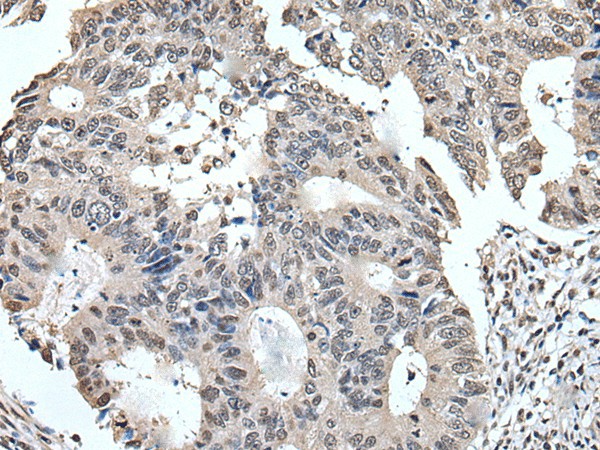 TRIM23 Polyclonal Antibody (E-AB-18298)