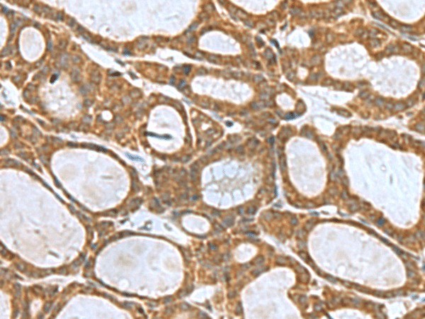 KIF2A Polyclonal Antibody (E-AB-19089)