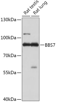 BBS7 Polyclonal Antibody (E-AB-91885)