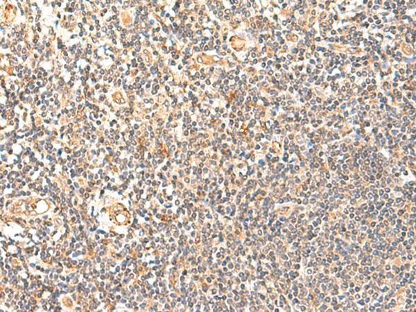 GPD1L Polyclonal Antibody (E-AB-52905)