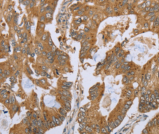 NLRP10 Polyclonal Antibody (E-AB-16648)
