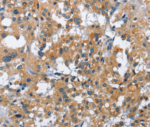CREB2 Polyclonal Antibody (E-AB-10176)