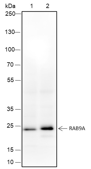 Recombinant Rab9A Monoclonal Antibody (AN301646L)