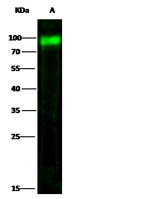 Recombinant CD155/PVR/NECL5 Monoclonal Antibody (AN300299P)
