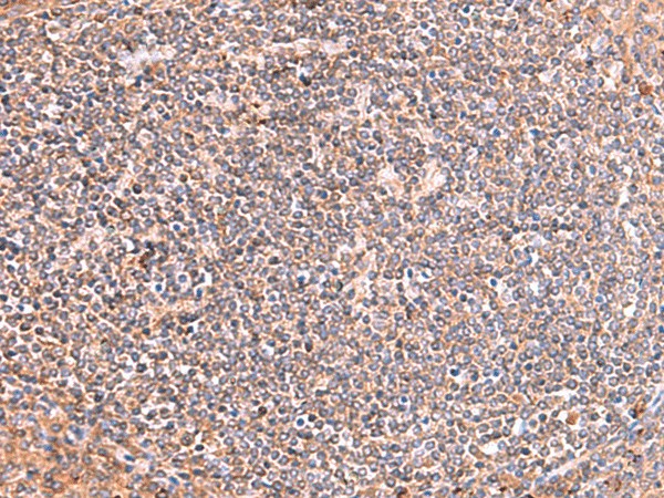 PHKG2 Polyclonal Antibody (E-AB-52938)