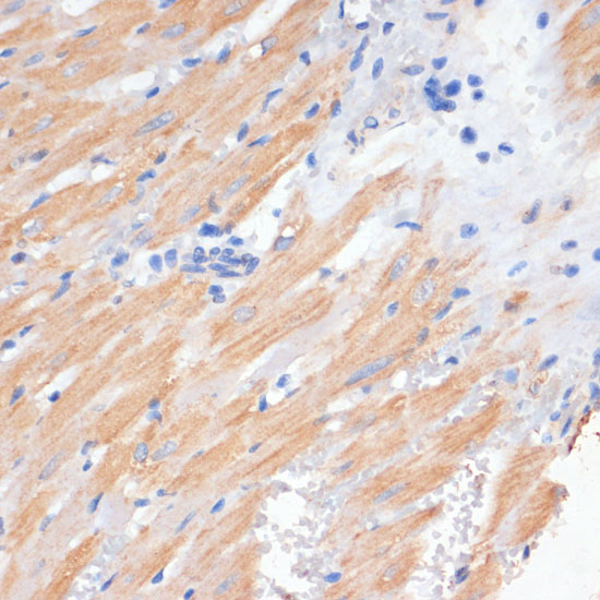 PDCD2L Polyclonal Antibody (E-AB-61684)