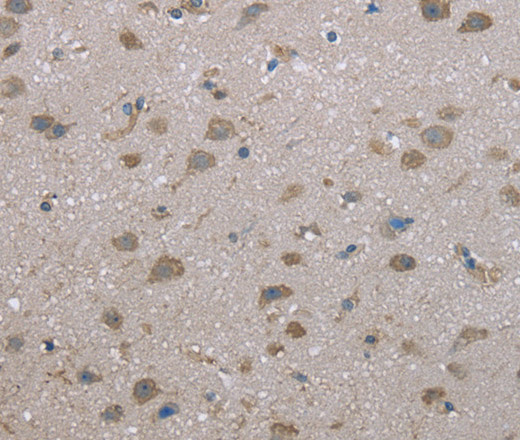FAP Polyclonal Antibody (E-AB-15017)