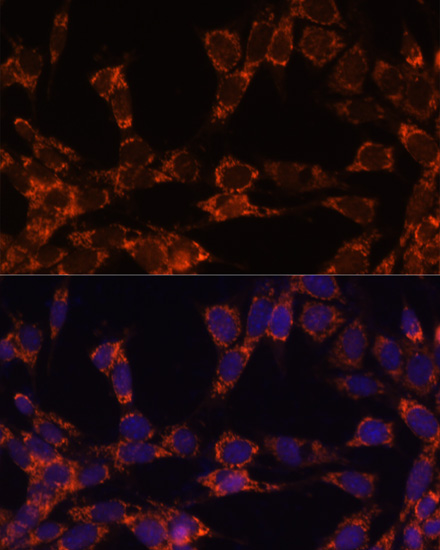 UBE2F Polyclonal Antibody (E-AB-63211)