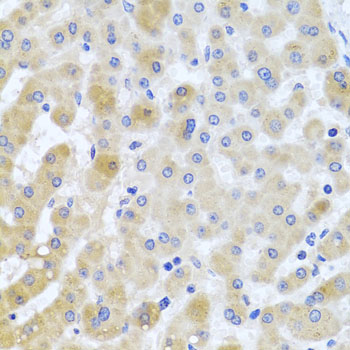 EIF3M Polyclonal Antibody (E-AB-63035)
