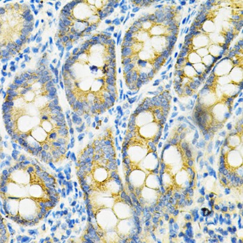 HGF Polyclonal Antibody (E-AB-60245)