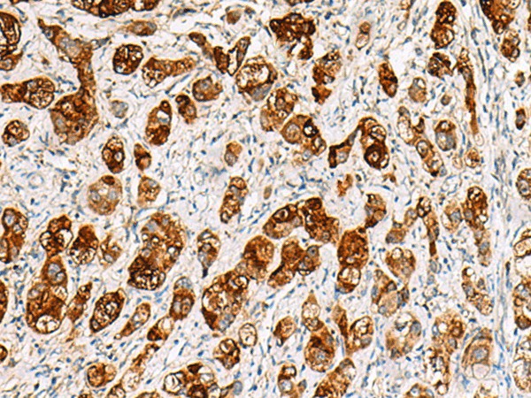 SAA1 Polyclonal Antibody (E-AB-52681)