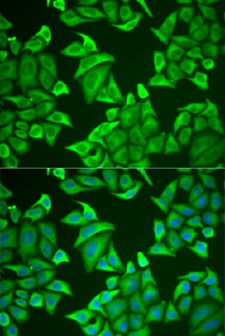 NGB Polyclonal Antibody (E-AB-61991)