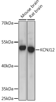 KCNJ12 Polyclonal Antibody (E-AB-90822)