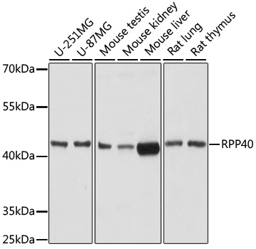 RPP40 Polyclonal Antibody (E-AB-67048)